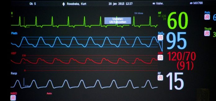 real-time-monitoring-chart